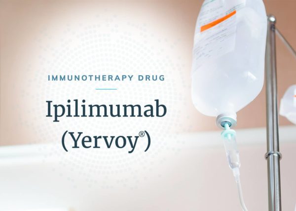 IV drug solution in a hanging bag containing ipilimumab, an immunotherapy drug for mesothelioma.